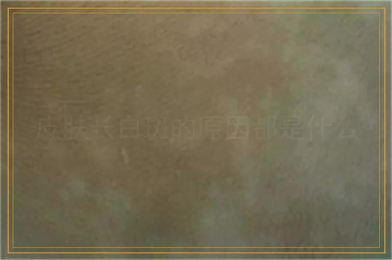 皮肤长白斑的原因都是什么