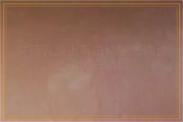 女孩乳房上有白块怎么确诊是不是白癜风