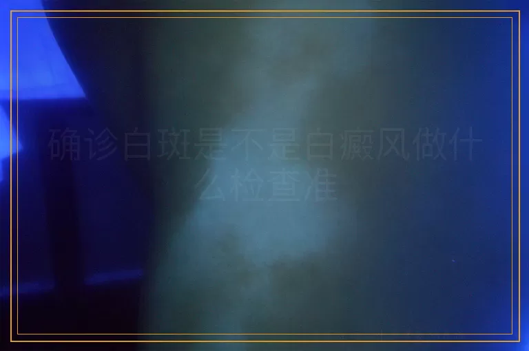 确诊白斑是不是白癜风做什么检查准