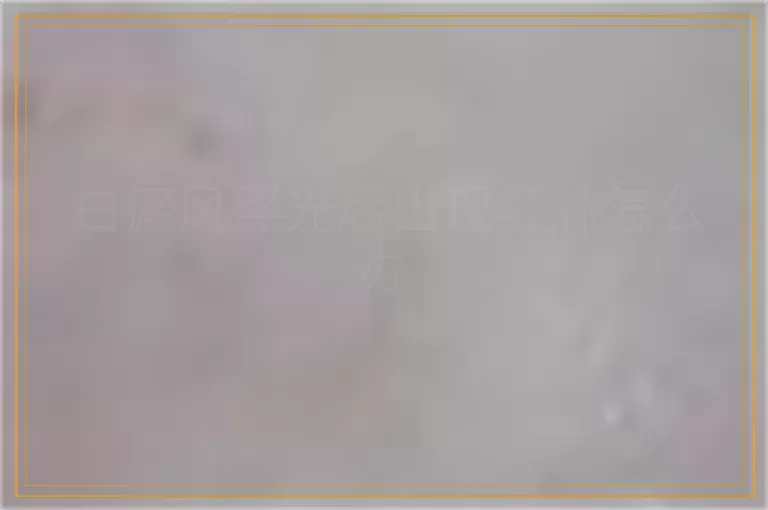 白癜风照光后出现红肿怎么办