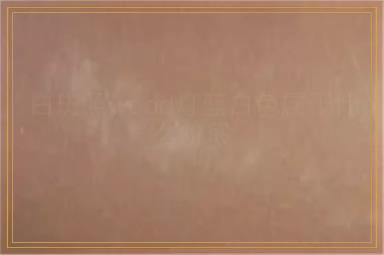 白斑照wood灯蓝白色属于什么阶段