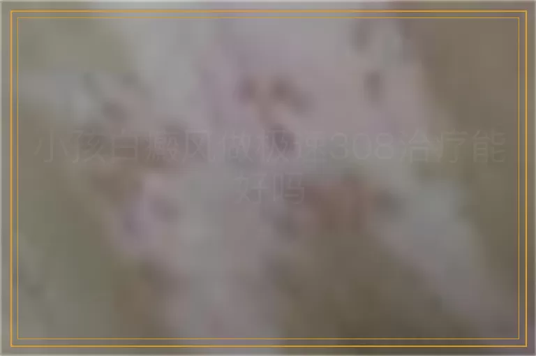 小孩白癜风做极速308治疗能好吗