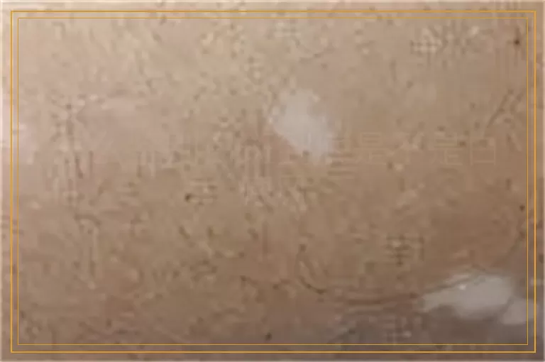 怎么鉴别白斑到底是不是白癜风