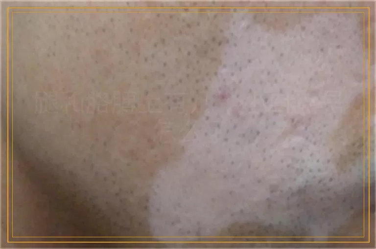 腿和胳膊上有几个小白点是怎么了