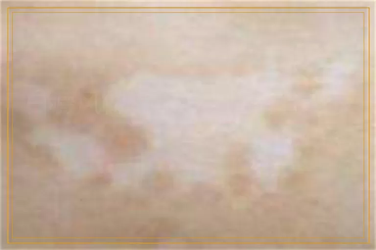 白癜风做完308之后有什么反应