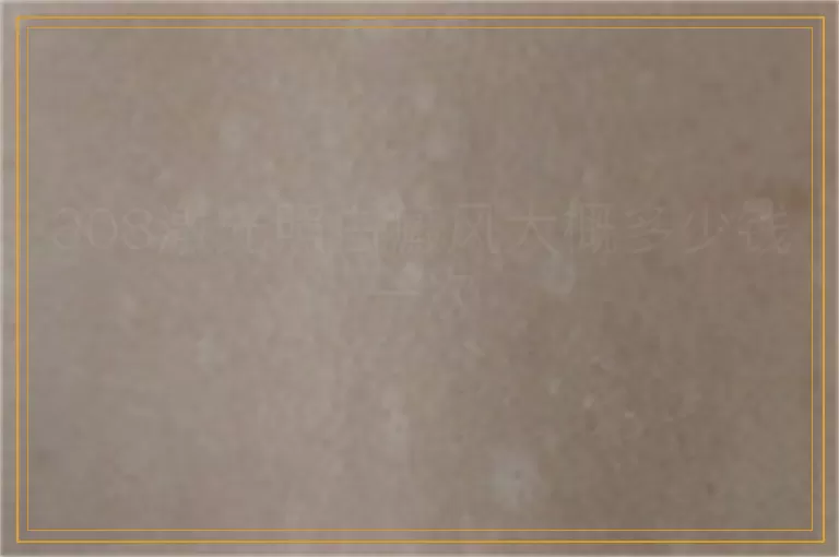 308激光照白癜风大概多少钱一次