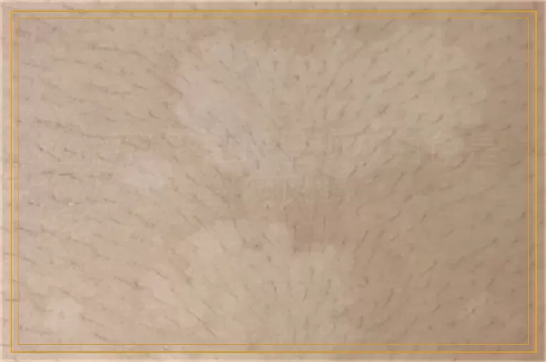 伍德灯下白斑呈现灰白色是白癜风吗