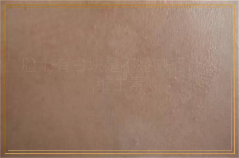 脸上有白块是不是缺乏什么维生素