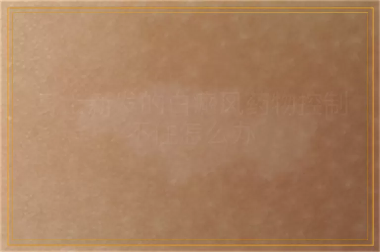 身上新发的白癜风药物控制不住怎么办