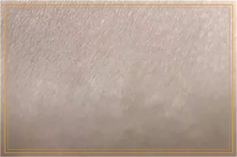 不同地区的白癜风治疗费用差异大吗