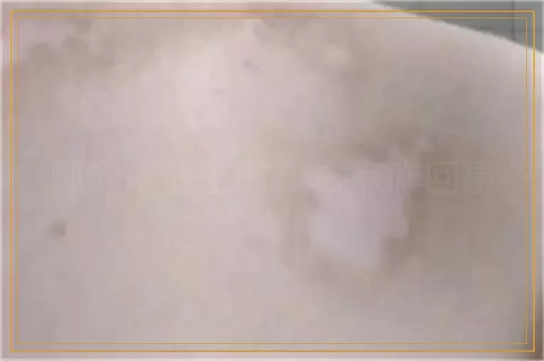 腿的皮肤上有小白点咋回事