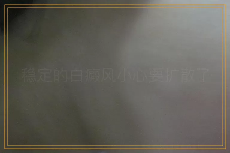 稳定的白癜风小心要扩散了