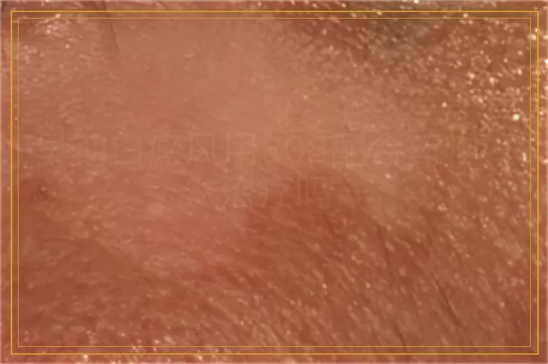 早期白癜风用308配合药物好治疗吗