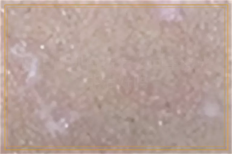 脸上出现白斑怎么回事激光能治好吗