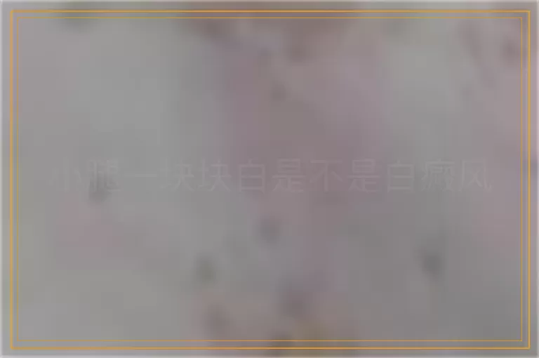 小腿一块块白是不是白癜风