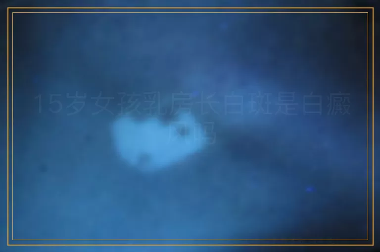 15岁女孩乳房长白斑是白癜风吗