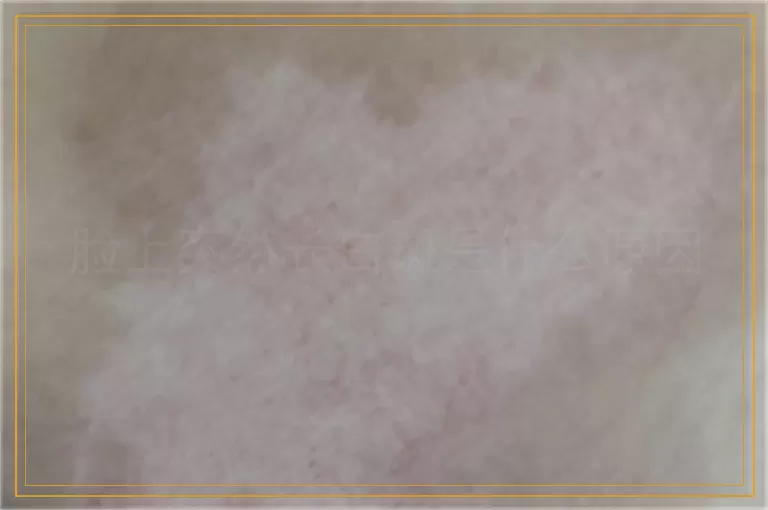 脸上突然长白斑是什么原因