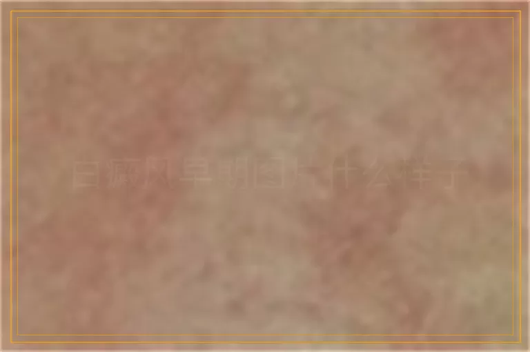 白癜风早期图片什么样子