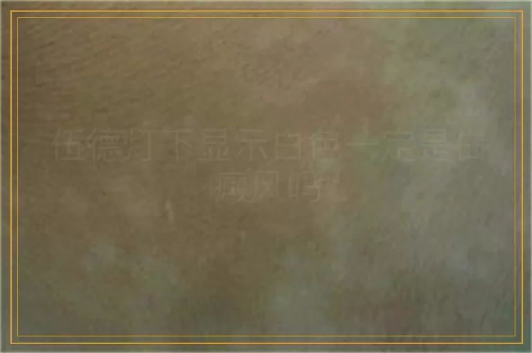 伍德灯下显示白色一定是白癜风吗