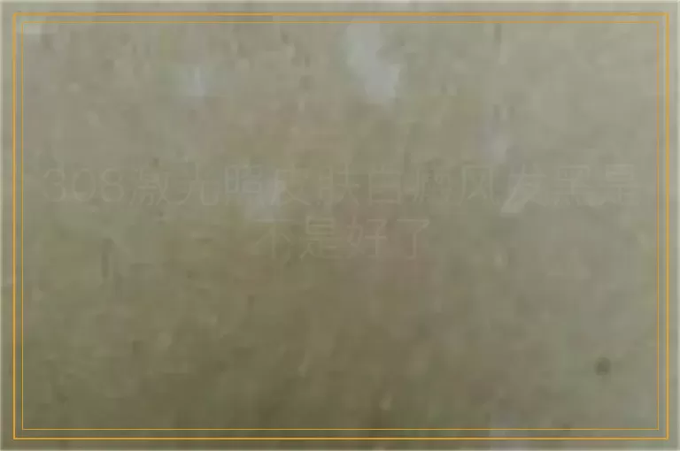 308激光照皮肤白癜风发黑是不是好了