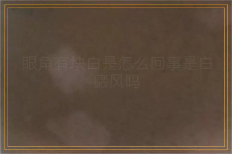 眼角有块白是怎么回事是白癜风吗