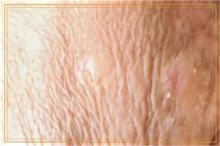 淘宝上卖的白癜风308光疗机治疗效果怎么样