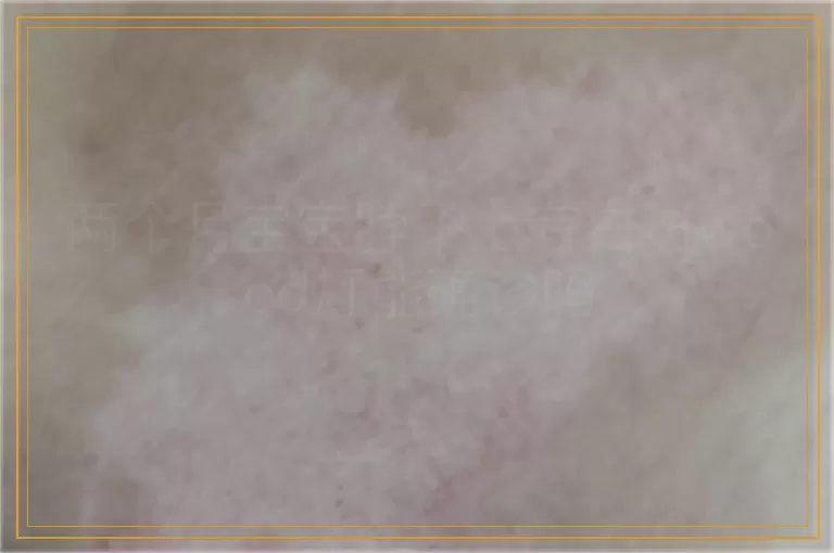 两个月宝宝脖子上有白斑wood灯能确诊吗
