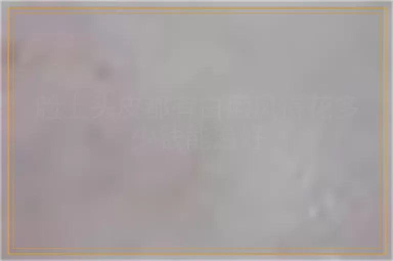 脸上头皮都有白癜风得花多少钱能治好