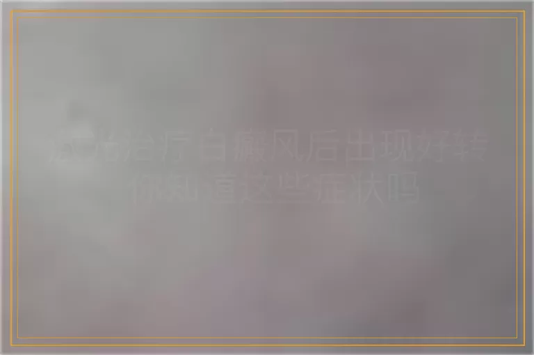 激光治疗白癜风后出现好转 你知道这些症状吗