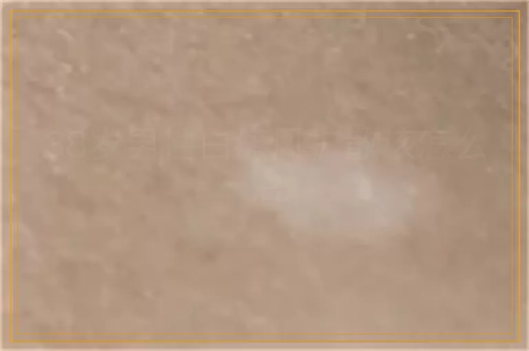 38岁男性白癜风扩散该怎么治