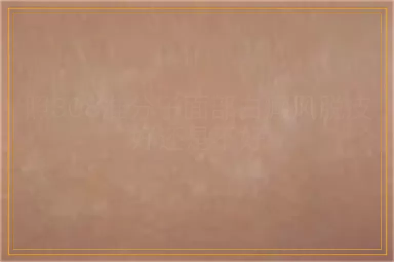 照308准分子面部白癜风脱皮好还是不好
