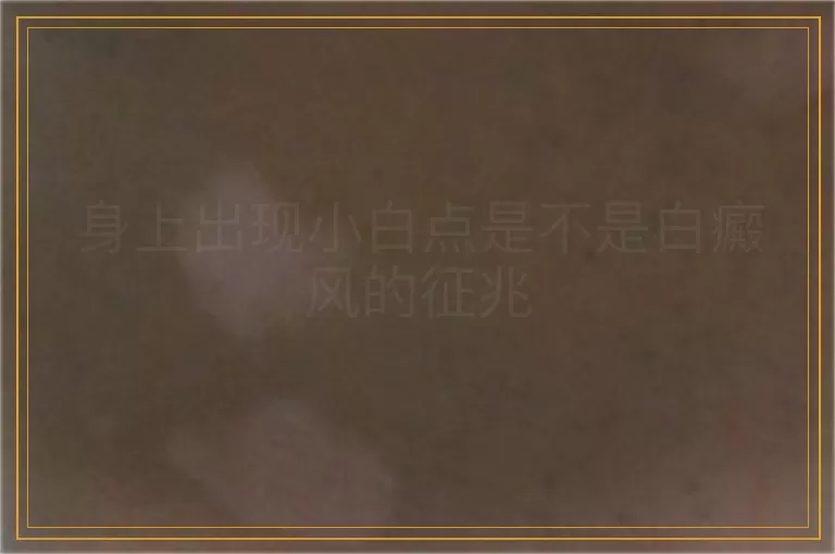 身上出现小白点是不是白癜风的征兆