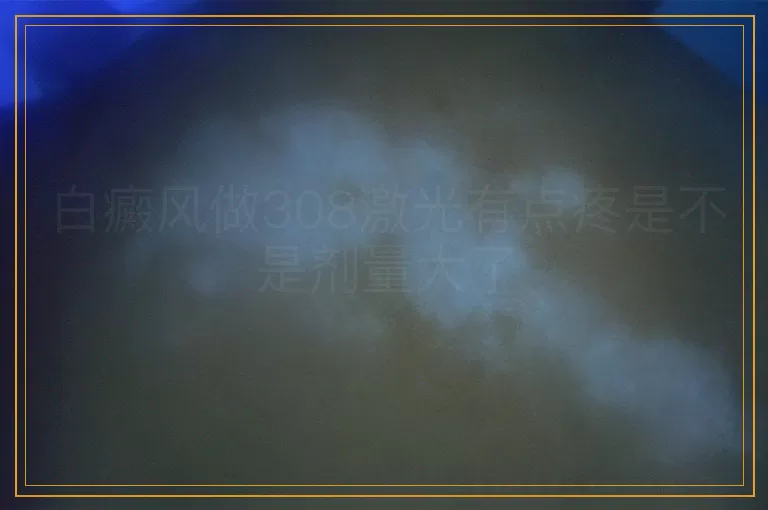 白癜风做308激光有点疼是不是剂量大了