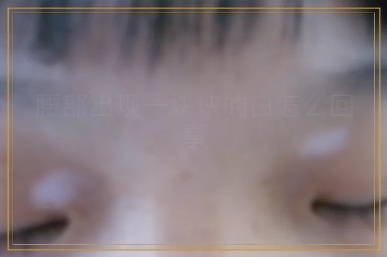 腰部出现一块块的白怎么回事