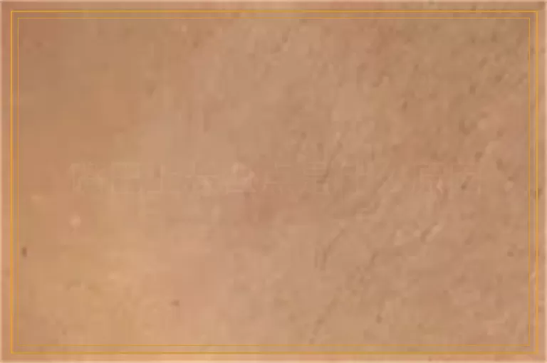 嘴巴上长白点是什么原因