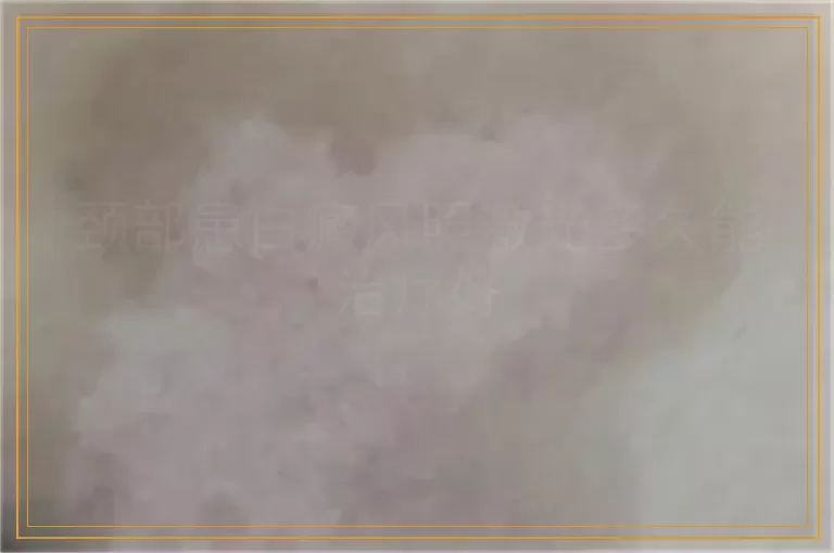 颈部患白癜风照激光多久能治疗好