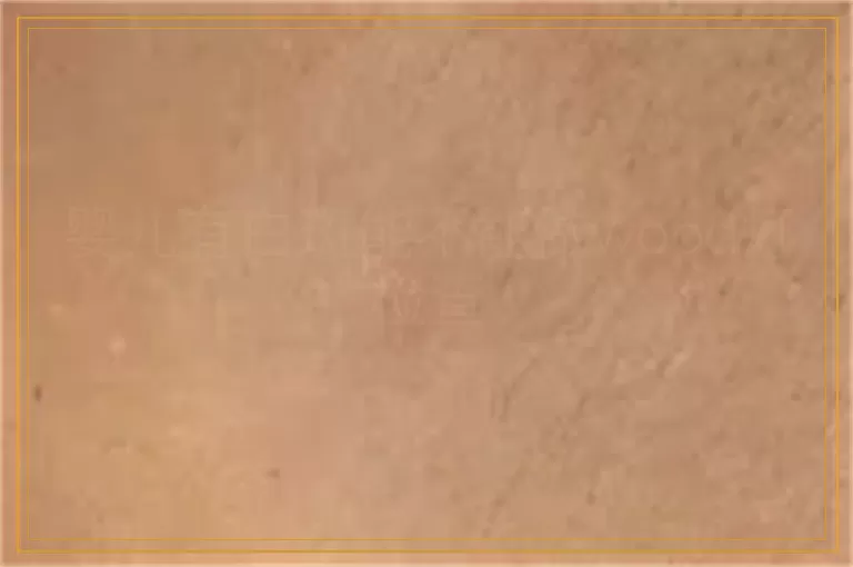 婴儿有白斑能不能做wood灯检查