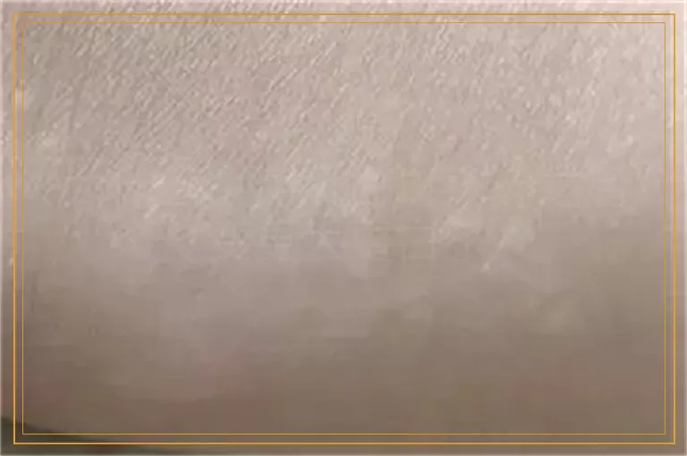 为什么白癜风白斑抹药之后变更大更白了