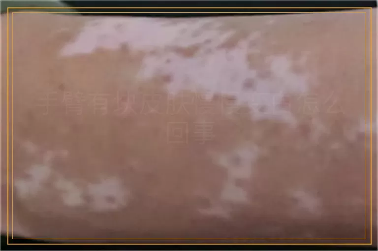 手臂有块皮肤慢慢变白怎么回事