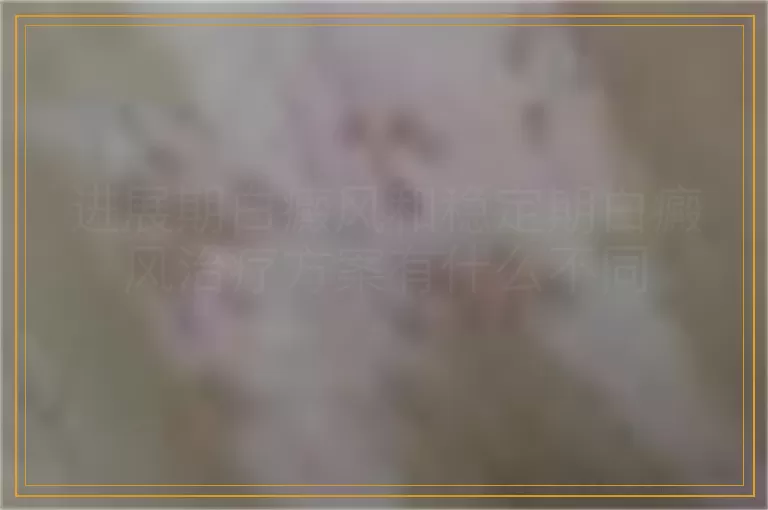 进展期白癜风和稳定期白癜风治疗方案有什么不同