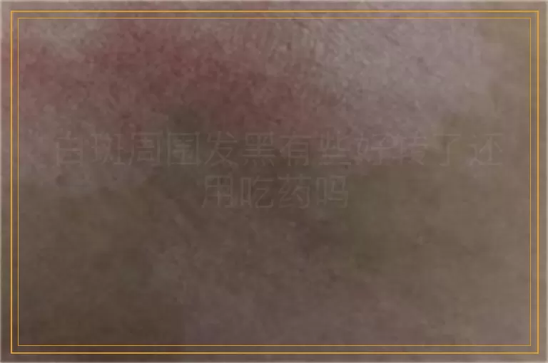 白斑周围发黑有些好转了还用吃药吗