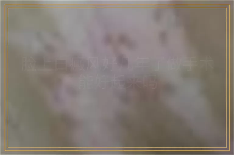 脸上白癜风好几年了做手术能好起来吗