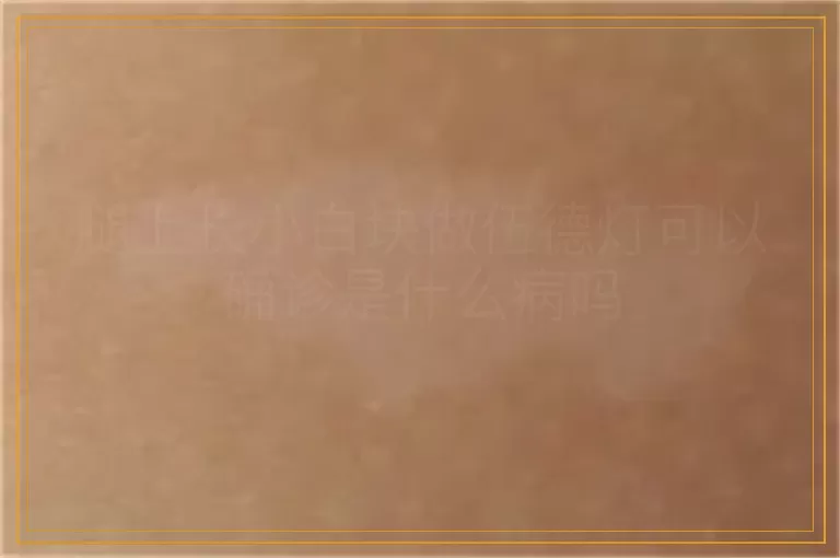 腿上长小白块做伍德灯可以确诊是什么病吗