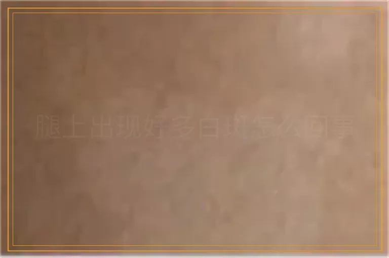 腿上出现好多白斑怎么回事