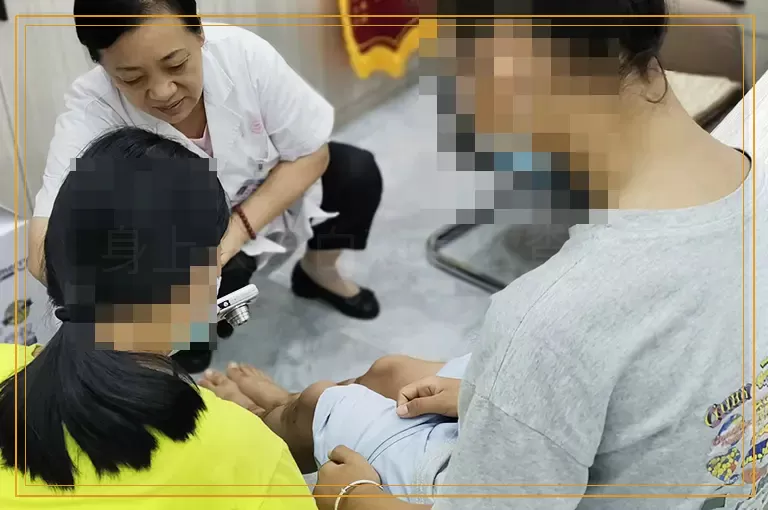 身上长了白斑怎么查病因