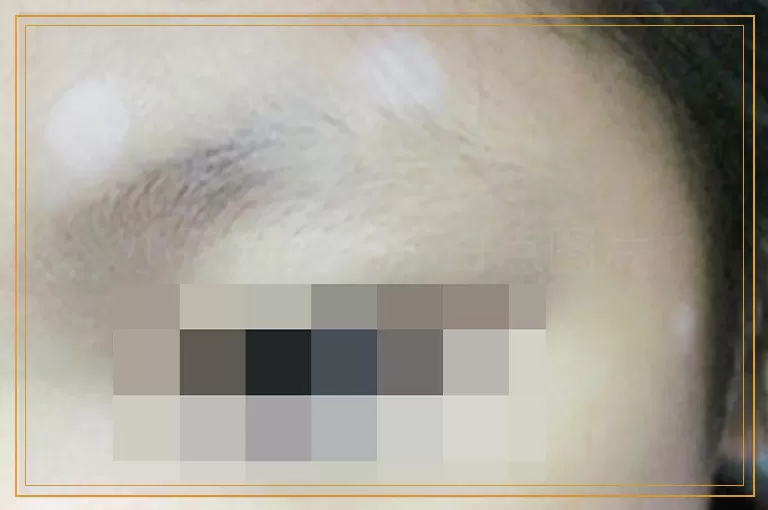 小孩脸上长小白点图片