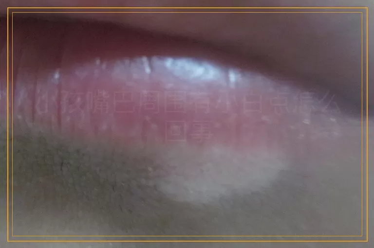 小孩嘴巴周围有小白点怎么回事