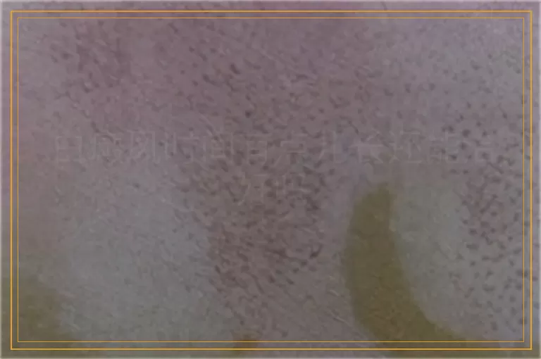 白癜风时间有点儿长还能治好吗