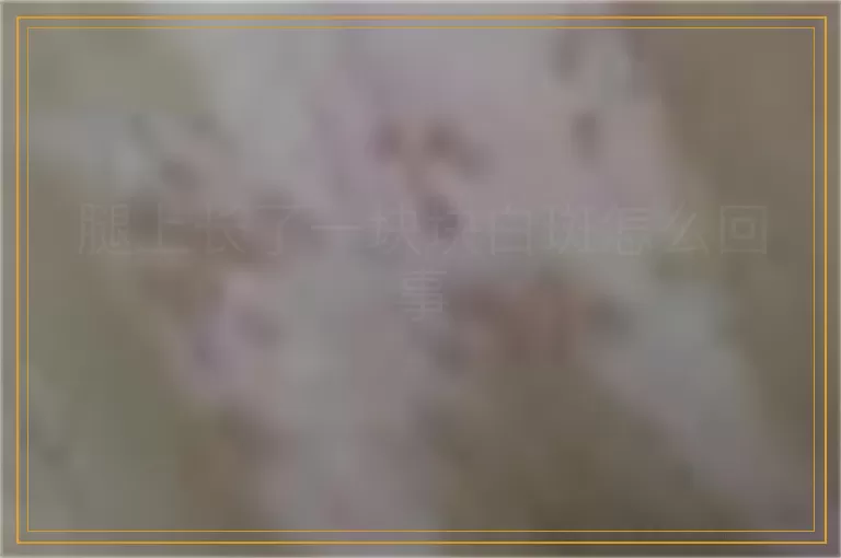 腿上长了一块块白斑怎么回事