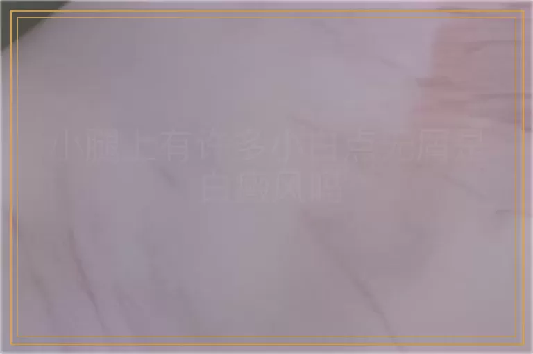 小腿上有许多小白点无屑是白癜风吗